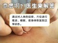 非物质文化遗产 截根术（截根术是什么 新手三分钟看懂）