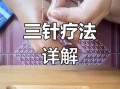 非物质文化遗产扎针（非遗扎针怎么入门：新手从零开始学）