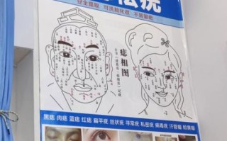 非物质文化遗产痣(非遗点痣技艺是什么) 非物质文化遗产痣(非遗点痣技艺是什么)