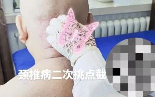 颈椎非物质文化遗产（颈椎非遗疗法有哪些值得新手尝试）