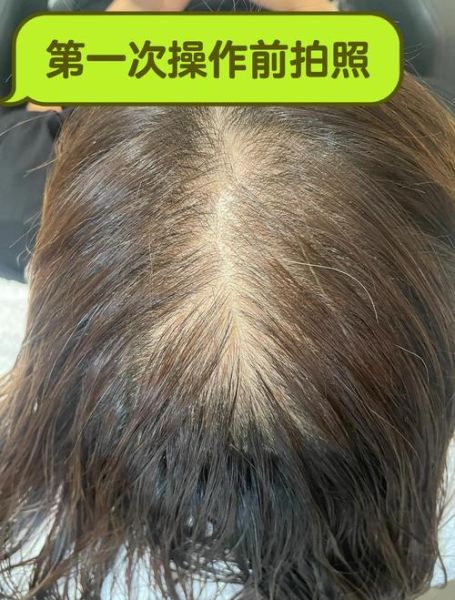 生发非物质文化遗产(生发非遗是真的吗)-第3张图片-八三百科 生发非物质文化遗产(生发非遗是真的吗)-第3张图片-八三百科