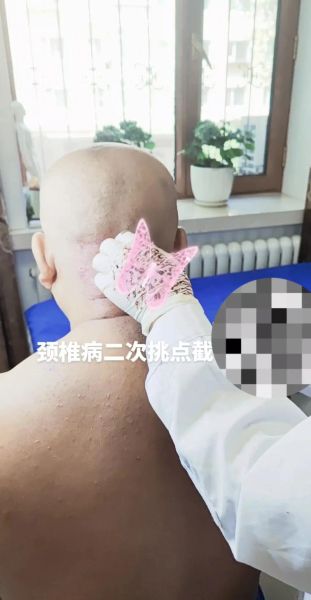 颈椎非物质文化遗产(颈椎非遗疗法有哪些值得新手尝试)-第1张图片-八三百科 颈椎非物质文化遗产(颈椎非遗疗法有哪些值得新手尝试)-第1张图片-八三百科