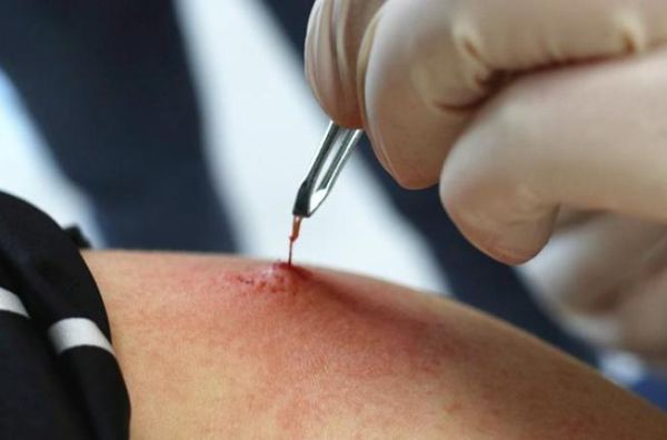 截根术非物质文化遗产（截根术非物质文化遗产保护现状）-第2张图片-八三百科