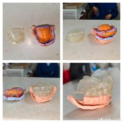 假牙非物质文化遗产（假牙非遗手工技艺有哪些地方传人）-第1张图片-八三百科