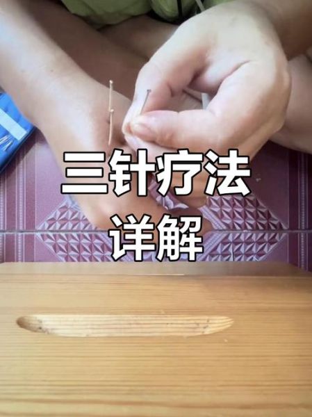 非物质文化遗产扎针（非遗扎针怎么入门：新手从零开始学）-第1张图片-八三百科